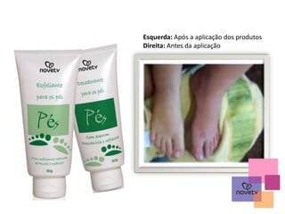 Esquerda: Após a aplicação dos produtos
Direita: Antes da aplicação
 