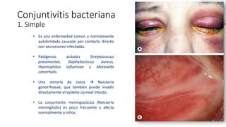 • Es una enfermedad común y normalmente
autolimitada causada por contacto directo
con secreciones infectadas.
• Patógenos aislados Streptococcus
pneumoniae, Staphylococcus aureus,
Haemophilus influenzae y Moraxella
catarrhalis.
• Una minoría de casos  Neisseria
gonorrhoeae, que también puede invadir
directamente el epitelio corneal intacto.
• La conjuntivitis meningocócica (Neisseria
meningitidis) es poco frecuente y afecta
normalmente a niños.
Conjuntivitis bacteriana
1. Simple
 