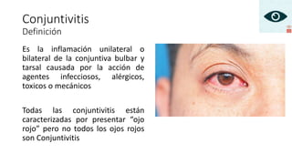 Es la inflamación unilateral o
bilateral de la conjuntiva bulbar y
tarsal causada por la acción de
agentes infecciosos, alérgicos,
toxicos o mecánicos
Todas las conjuntivitis están
caracterizadas por presentar “ojo
rojo” pero no todos los ojos rojos
son Conjuntivitis
Conjuntivitis
Definición
 