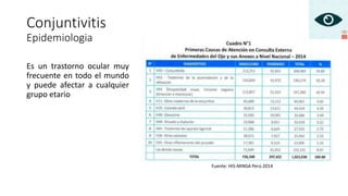 Conjuntivitis
Epidemiologia
Fuente: HIS-MINSA Perú 2014
Es un trastorno ocular muy
frecuente en todo el mundo
y puede afectar a cualquier
grupo etario
 