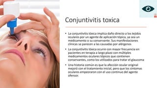 Conjuntivitis toxica
• La conjuntivitis tóxica implica daño directo a los tejidos
oculares por un agente de aplicación tópica, ya sea un
medicamento o su conservante. Sus manifestaciones
clínicas se parecen a las causadas por alérgenos
• La conjuntivitis tóxica ocurre con mayor frecuencia en
pacientes en terapia a largo plazo con múltiples
medicamentos oculares tópicos que contienen
conservantes, como los utilizados para tratar el glaucoma
• Una historia común es que la afección ocular original
mejoró con el tratamiento inicial, pero que los síntomas
oculares empeoraron con el uso continuo del agente
ofensor.
 