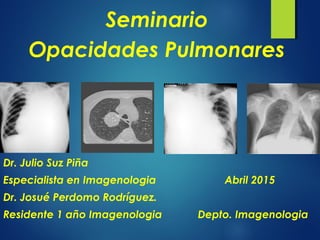 Seminario
Opacidades Pulmonares
Dr. Julio Suz Piña
Especialista en Imagenologia Abril 2015
Dr. Josué Perdomo Rodríguez.
Residente 1 año Imagenologia Depto. Imagenologia
 