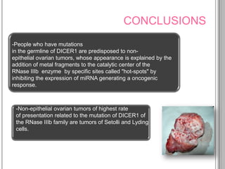 CONCLUSIONS
-People who have mutations
in the germline of DICER1 are predisposed to non-
epithelial ovarian tumors, whose appearance is explained by the
addition of metal fragments to the catalytic center of the
RNase IIIb enzyme by specific sites called "hot-spots" by
inhibiting the expression of miRNA generating a oncogenic
response.



 -Non-epithelial ovarian tumors of highest rate
 of presentation related to the mutation of DICER1 of
 the RNase IIIb family are tumors of Setolli and Lyding
 cells.
 