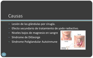 Causas
• Lesión de las glándulas por cirugía.
• Efecto secundario de tratamiento de yodo radiactivo.
• Niveles bajos de magnesio en sangre
• Síndrome de DiGeorge
• Síndrome Poliglandular Autoinmune
25
 