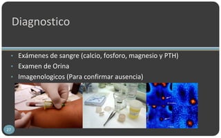 Diagnostico
• Exámenes de sangre (calcio, fosforo, magnesio y PTH)
• Examen de Orina
• Imagenologicos (Para confirmar ausencia)
27
 