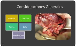 Consideraciones Generales
Número Tamaño
Forma Color
Localización
3
 