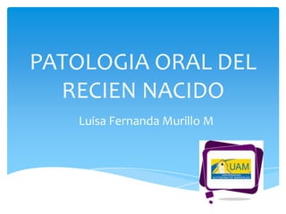 PATOLOGIA ORAL DEL
  RECIEN NACIDO
   Luisa Fernanda Murillo M
 