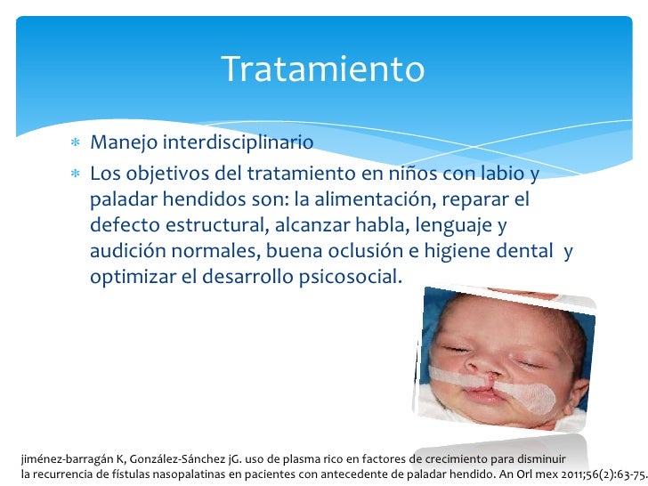 Patologia Oral Del Recien Nacido Labio Y Paladar Hendido