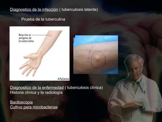 Diagnostico de la infección  ( tuberculosis latente) Prueba de la tuberculina Diagnostico de la enfermedad  ( tuberculosis clínica) Historia clínica y la radiología Baciloscopia Cultivo para micobacterias 