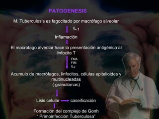 M. Tuberculosis es fagocitado por macrófago alveolar Inflamación El macrófago alveolar hace la presentación antigénica al linfocito T Acumulo de macrófagos, linfocitos, células epitelioides y multinucleadas ( granulomas) Lisis celular  caseificación Formación del complejo de Gonh “  Primoinfección Tuberculosa” PATOGENESIS IL   1 FMA FIM IL 2 