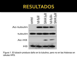 Figura 1. El tubacin produce daño en la tubulina, pero no en las histonas en células HFS. 