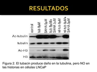 Figura 2. El tubacin produce daño en la tubulina, pero NO en las histonas en células LNCaP 