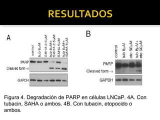 Figura 4. Degradación de PARP en células LNCaP. 4A. Con tubacin, SAHA o ambos. 4B. Con tubacin, etopocido o ambos. 