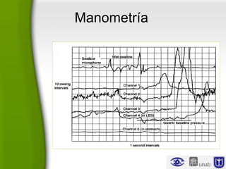 Manometría
 