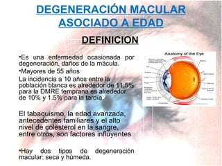 DEGENERACIÓN MACULAR
ASOCIADO A EDAD
DEFINICION
•Es una enfermedad ocasionada por
degeneración, daños de la mácula.
•Mayores de 55 años
La incidencia a 10 años entre la
población blanca es alrededor de 11,5%
para la DMRE temprana es alrededor
de 10% y 1.5% para la tardía.

El tabaquismo, la edad avanzada,
antecedentes familiares y el alto
nivel de colesterol en la sangre,
entre otros, son factores influyentes
•Hay dos tipos de degeneración
macular: seca y húmeda.

 