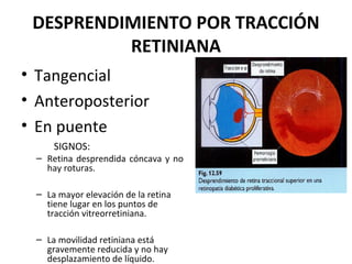 DESPRENDIMIENTO POR TRACCIÓN 
RETINIANA
• Tangencial
• Anteroposterior
• En puente
SIGNOS:

– Retina desprendida cóncava y no
hay roturas.
– La mayor elevación de la retina
tiene lugar en los puntos de
tracción vitreorretiniana.
– La movilidad retiniana está
gravemente reducida y no hay
desplazamiento de líquido.

 