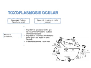 Causada por Parásito:
Toxoplasma gondii

Medios de
Transmisión

Causa más frecuente de uveítis
posterior

- Ingestión de quistes de tejidos que
se encuentran en la carne cruda de
animales infectados.
- Ingestión de ooquistes. Directamente
por el gato o por medio de otros
vectores.
- Vía transplacentaria. Madre-Feto

 