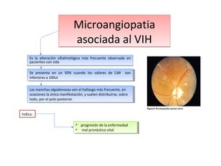 Microangiopatia
asociada al VIH
Es la alteración oftalmológica más frecuente observada en
pacientes con sida
Se presenta en un 50% cuando los valores de Cd4 son
Se presenta en un 50% cuando los valores de Cd4 son
inferiores aa 100ul
inferiores 100ul
Las manchas algodonosas son el hallazgo más frecuente, en
Las manchas algodonosas son el hallazgo más frecuente, en
ocasiones la única manifestación, yy suelen distribuirse, sobre
ocasiones la única manifestación, suelen distribuirse, sobre
todo, por el polo posterior.
todo, por el polo posterior.
Indica:
• • progresión de la enfermedad
progresión de la enfermedad
• • mal pronóstico vital
mal pronóstico vital

 