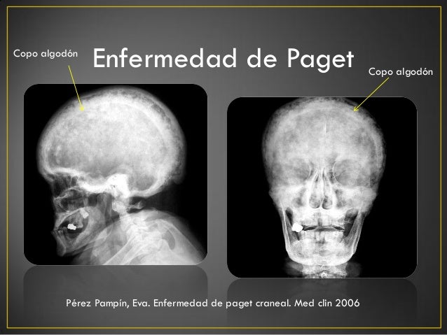 https://image.slidesharecdn.com/seminariorx-crneosebastinseplveda-130401203657-phpapp01/95/seminario-rxcrneo-7-638.jpg?cb=1364848662