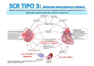 Rápido compromiso de la función renal (Isquemia o glomerulonefritis aguda), que lleva a la
                    disfunción cardiaca aguda (IC, arritmia o isquemia)




                                                              Activación de la NADPH-oxidasa
                                                           ↑ vasoconstricción y ↓ vasodilatación
                                                                  (ERO)             (NO)




                          IL-1, IL-6, TNF-α
                             Apoptosis                                                             IL-1, IL-6, TNF-α
Ronco C, Haapio M, House A. Cardiorenal Syndrome. J. Am.
Coll. Cardiol. 2008;52;1527-1539
 