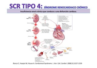 Insuficiencia renal crónica que conduce a una disfunción cardíaca.




Ronco C, Haapio M, House A. Cardiorenal Syndrome. J. Am. Coll. Cardiol. 2008;52;1527-1539
 