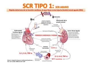 Rápido deterioro de la función cardiaca, lo que lleva a una injuria (lesión) renal aguda (IRA)




                                                       FIBROSIS CARDIACA Y RENAL




                                                                         NADPH-ox.



                       IL-1, IL-6, TNF-α
                                                                              IL-1, IL-6, TNF-α
                                                                          NP-Y: neoíntima
Ronco C, Haapio M, House A. Cardiorenal Syndrome. J.
Am. Coll. Cardiol. 2008;52;1527-1539
 