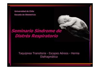 Universidad de Chile
 Escuela de Obstetricia




Seminario Síndrome de
 Distrés Respiratorio


     Taquipnea Transitoria - Escapes Aéreos - Hernia
                     Diafragmática
 
