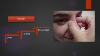 Palpación
Dolor
Fractura
Deformidad
 