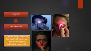 Inspección
Transiluminación
Cuarto oscuro, fuente de
luz, preferiblemente de
rayos convergentes,
adecuada intensidad
 