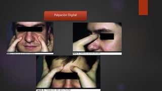Palpación Digital
 