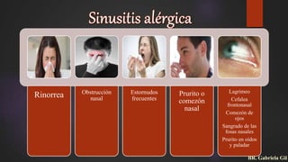 Rinorrea Obstrucción
nasal
Estornudos
frecuentes
Prurito o
comezón
nasal
Lagrimeo
Cefalea
frontonasal
Comezón de
ojos
Sangrado de las
fosas nasales
Prurito en oídos
y paladar
BR. Gabriela Gil
 