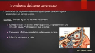 Complicación de un proceso infeccioso agudo que se caracteriza por la
presencia de un trombo séptico.
Etiología : Sinusitis aguda no tratada o recidivante.
Extracciones de los dientes antero superiores, en presencia de una
infección aguda. Y el raspaje de sus alvéolos.
Furúnculos y folículos infectados en la zona de la nariz.
Infección y/o trauma al oído.
BR. Gabriela Garavito
 