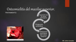 TRATAMIENTO:
Osteomielitis del maxilarsuperior.
Supresión de
la causa
dentogena
Protección
antibiótica
Extirpación
quirúrgica
del hueso
enfermo
BR. Carlos Gonzalez
 