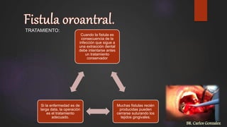 TRATAMIENTO:
Cuando la fistula es
consecuencia de la
infección que sigue a
una extracción dental
debe intentarse antes
un tratamiento
conservador
Muchas fistulas recién
producidas pueden
cerrarse suturando los
tejidos gingivales.
Si la enfermedad es de
larga data, la operación
es el tratamiento
adecuado.
BR. Carlos Gonzalez
 