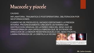 CAUSAS:
INFLAMATORIA, TRAUMATICA O POSTOPERATORIA, OBLITERACION POR
NEOFORMACIONES.
CUANDO NO SE PRODUCE EL VACIADO ESPONTANEO LA PRESION
INTERNA, PROGRESIVAMENTE CRECIENTE DETERMINA UNA
DESTRUCCION GRADUAL DE LA PARED OSEA DEL SENO QUE SE
TRANSFORMA EN UNA CAPSULA FIBROSA QUE SE EXTIENDE EN
DIRECCION DE LA MENOR RESISTENCIA(SUELO DEL SENO FRONTAL
LAMINA PAPIRACEA DE LA ORBITA) A LA VECINDAD.
BR. Carlos Gonzalez
 