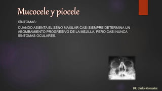 SÍNTOMAS:
CUANDO ASIENTA EL SENO MAXILAR CASI SIEMPRE DETERMINA UN
ABOMBAMIENTO PROGRESIVO DE LA MEJILLA, PERO CASI NUNCA
SÍNTOMAS OCULARES.
BR. Carlos Gonzalez
 
