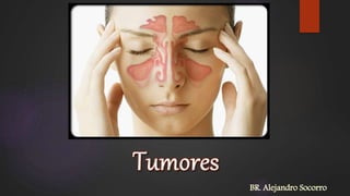 BR. Alejandro Socorro
 