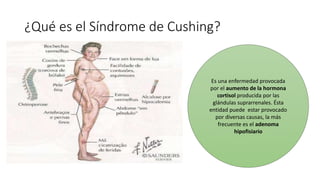 ¿Qué es el Síndrome de Cushing?
Es una enfermedad provocada
por el aumento de la hormona
cortisol producida por las
glándulas suprarrenales. Ésta
entidad puede estar provocado
por diversas causas, la más
frecuente es el adenoma
hipofisiario
 