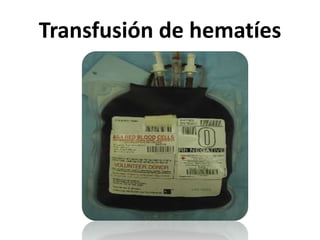 Transfusión de hematíes
 