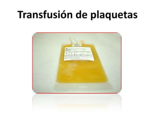 Transfusión de plaquetas
 