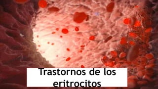 Trastornos de los
eritrocitos
 