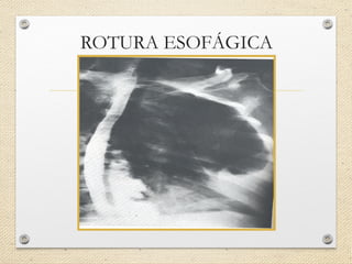 Trauma de tórax diagnóstico Imagenológico | PPT
