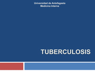TUBERCULOSIS
Universidad de Antofagasta
Medicina Interna
 