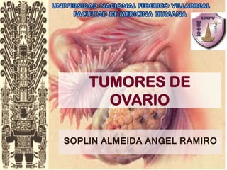 SOPLIN ALMEIDA ANGEL RAMIRO 
TUMORES DE OVARIO  