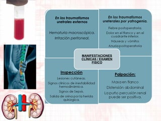 En los traumatismos
uretrales externos
Hematuria macroscópica.
Irritación peritoneal.

MANIFESTACIONES
CLÍNICAS / EXAMEN
FISICO

 