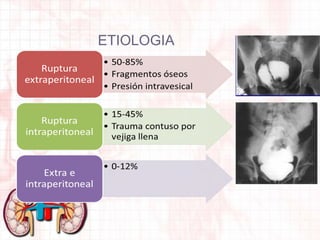 ETIOLOGIA

 