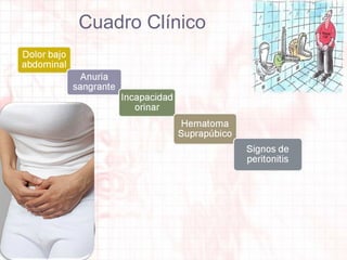 Cuadro Clínico

 