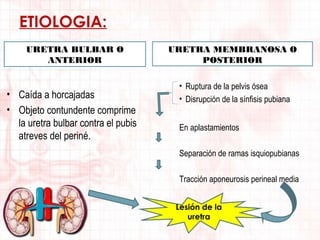 ETIOLOGIA:
URETRA BULBAR O
ANTERIOR

• Caída a horcajadas
• Objeto contundente comprime
la uretra bulbar contra el pubis
atreves del periné.

URETRA MEMBRANOSA O
POSTERIOR
• Ruptura de la pelvis ósea
• Disrupción de la sínfisis pubiana
En aplastamientos
Separación de ramas isquiopubianas
Tracción aponeurosis perineal media
Lesión de la
uretra

 