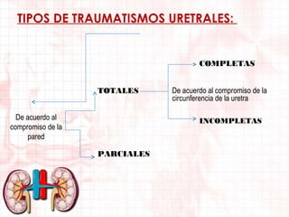 TIPOS DE TRAUMATISMOS URETRALES:

COMPLETAS
TOTALES
De acuerdo al
compromiso de la
pared

De acuerdo al compromiso de la
circunferencia de la uretra
INCOMPLETAS

PARCIALES

 