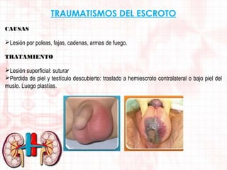 TRAUMATISMOS DEL ESCROTO
CAUSAS

Lesión por poleas, fajas, cadenas, armas de fuego.
TRATAMIENTO

Lesión superficial: suturar
Perdida de piel y testículo descubierto: traslado a hemiescroto contralateral o bajo piel del
muslo. Luego plastías.

 
